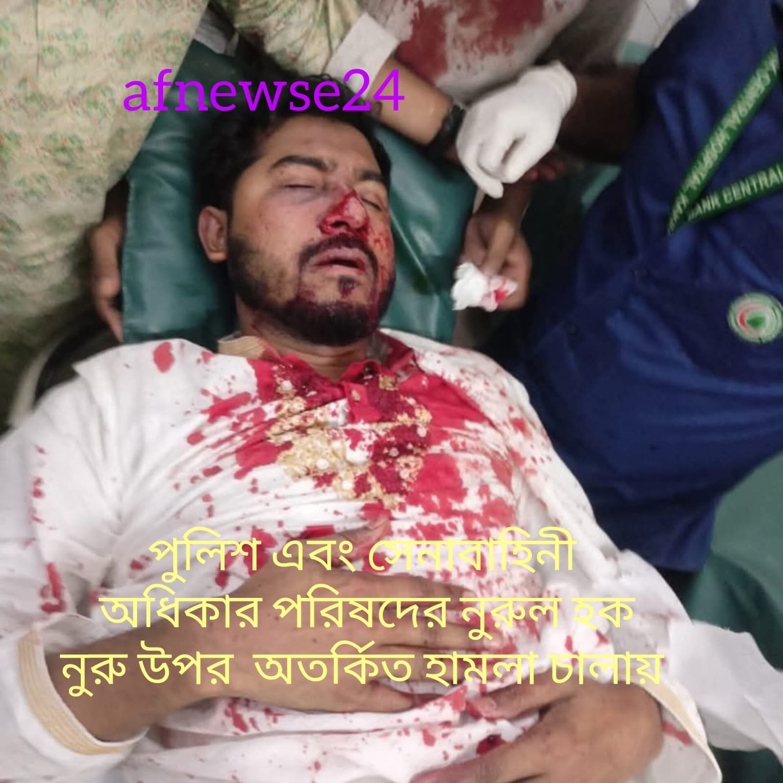 ভিপি নুরুল হক নুরের উপর হামলা